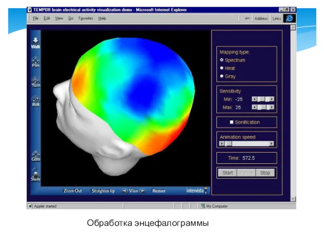 Обработка энцефалограммы