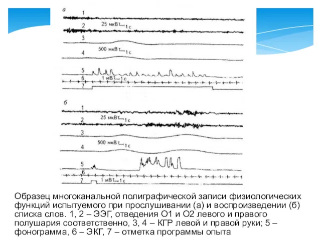 Образец многоканальной полиграфической записи физиологических функций испытуемого при прослушивании (а)