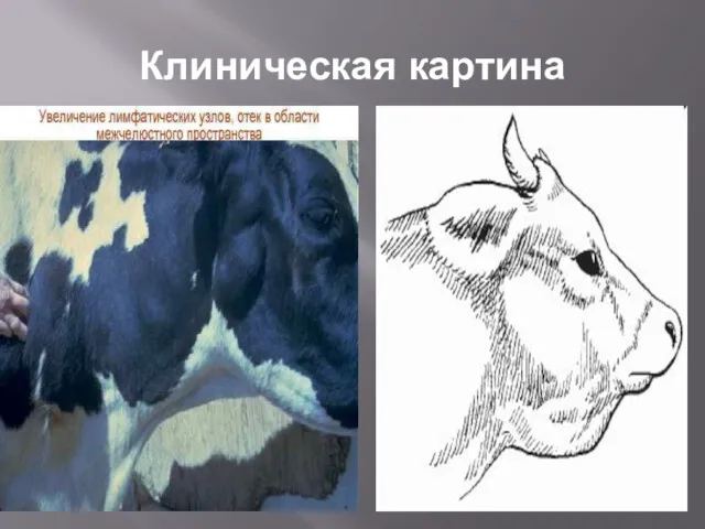 Клиническая картина