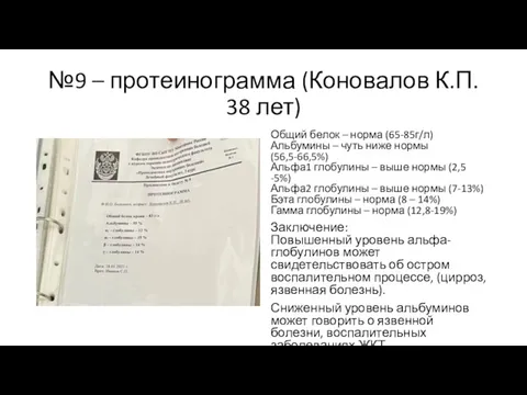 №9 – протеинограмма (Коновалов К.П. 38 лет) Общий белок –