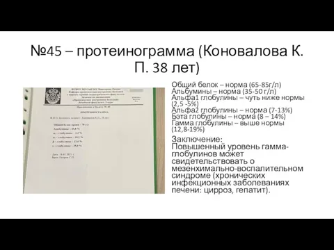 №45 – протеинограмма (Коновалова К.П. 38 лет) Общий белок –