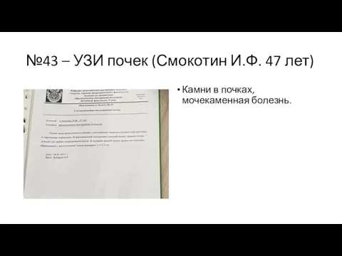 №43 – УЗИ почек (Смокотин И.Ф. 47 лет) Камни в почках, мочекаменная болезнь.