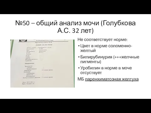 №50 – общий анализ мочи (Голубкова А.С. 32 лет) Не