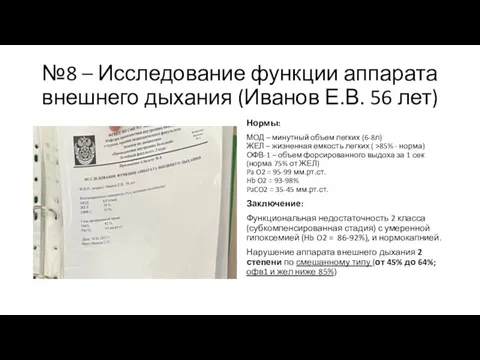 №8 – Исследование функции аппарата внешнего дыхания (Иванов Е.В. 56