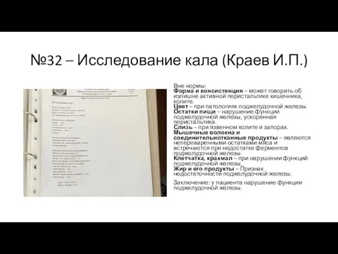 №32 – Исследование кала (Краев И.П.) Вне нормы: Форма и