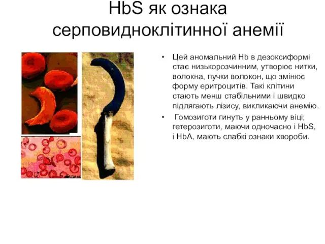 HbS як ознака серповидноклітинної анемії Цей аномальний Hb в дезоксиформі