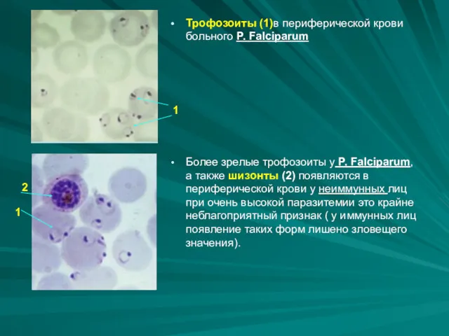 Трофозоиты (1)в периферической крови больного P. Falciparum Более зрелые трофозоиты у P. Falciparum,