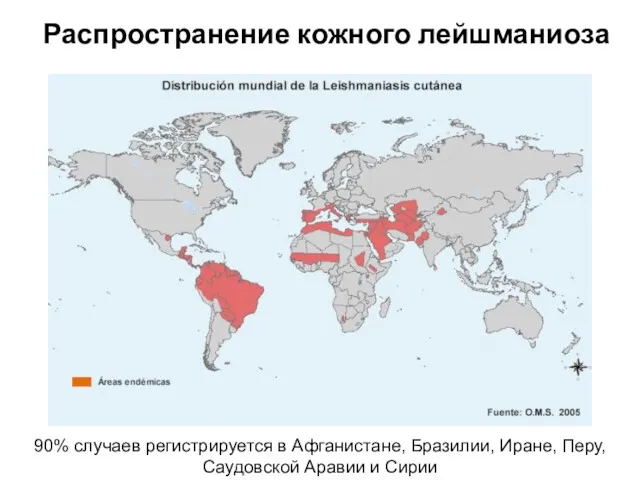 Распространение кожного лейшманиоза 90% случаев регистрируется в Афганистане, Бразилии, Иране, Перу, Саудовской Аравии и Сирии