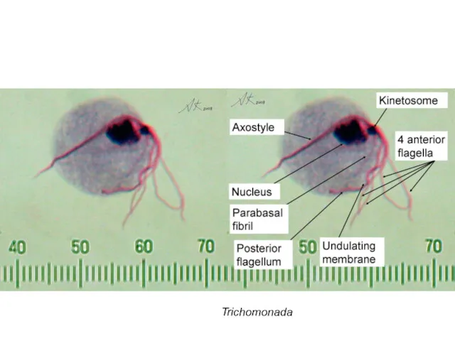 Trichomonada