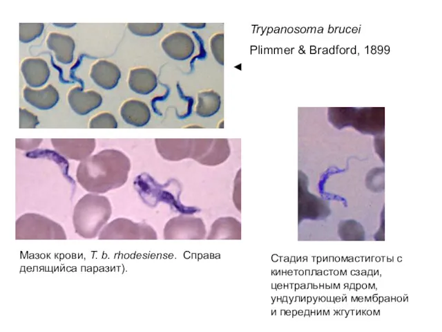 Мазок крови, T. b. rhodesiense. Справа делящийса паразит). Стадия трипомастиготы