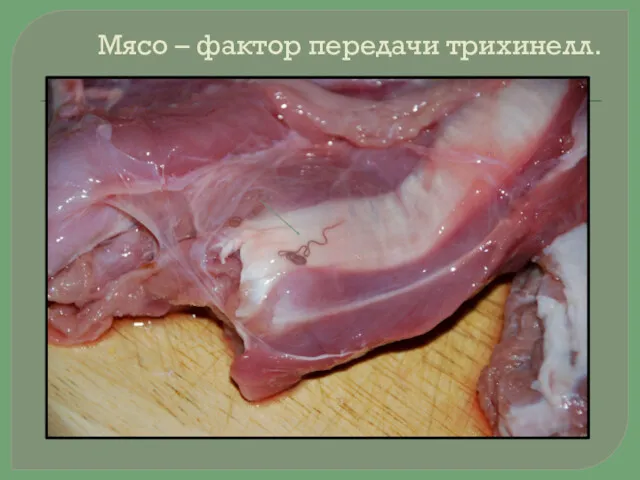 Мясо – фактор передачи трихинелл.