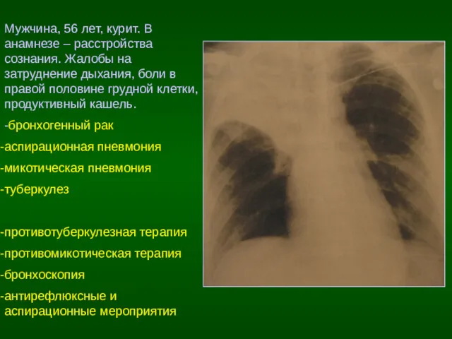 Мужчина, 56 лет, курит. В анамнезе – расстройства сознания. Жалобы