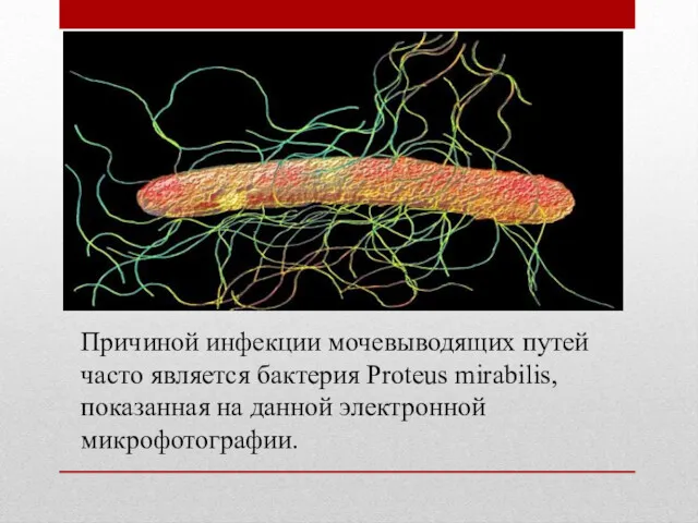 Причиной инфекции мочевыводящих путей часто является бактерия Proteus mirabilis, показанная на данной электронной микрофотографии.
