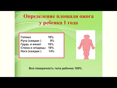 Определение площади ожога у ребенка 1 года Голова 18% Рука (каждая ) 9%