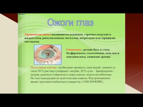 Ожоги глаз Симптомы : резкая боль в глазу, блефароспазм, слезотечение, отек век и