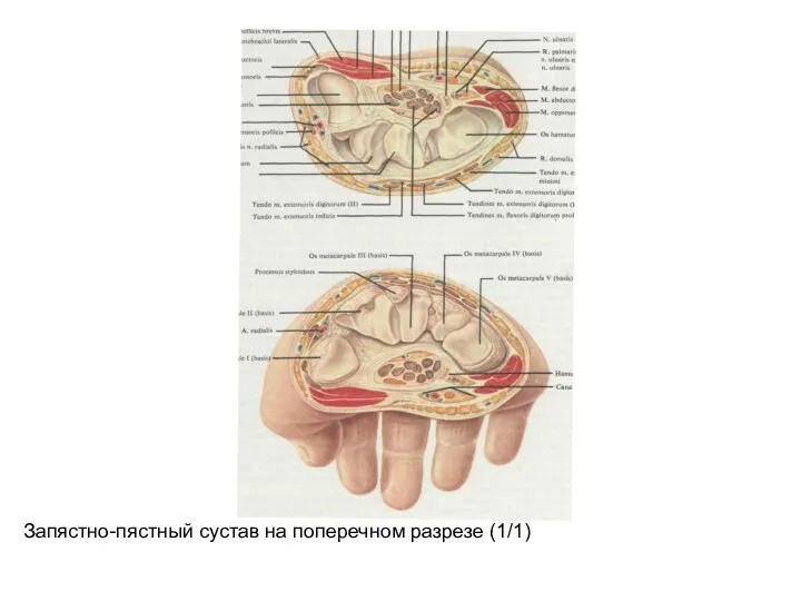 Запястно-пястный сустав на поперечном разрезе (1/1)