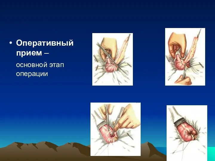 Оперативный прием – основной этап операции