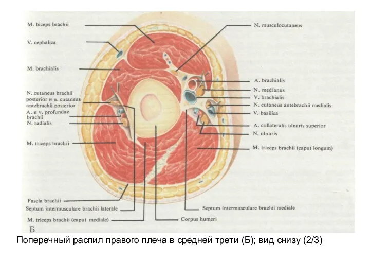 Поперечный распил правого плеча в средней трети (Б); вид снизу (2/3)