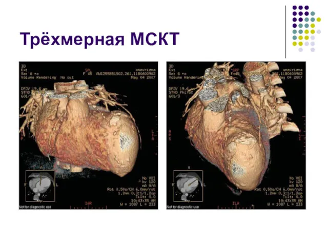 Трёхмерная МСКТ