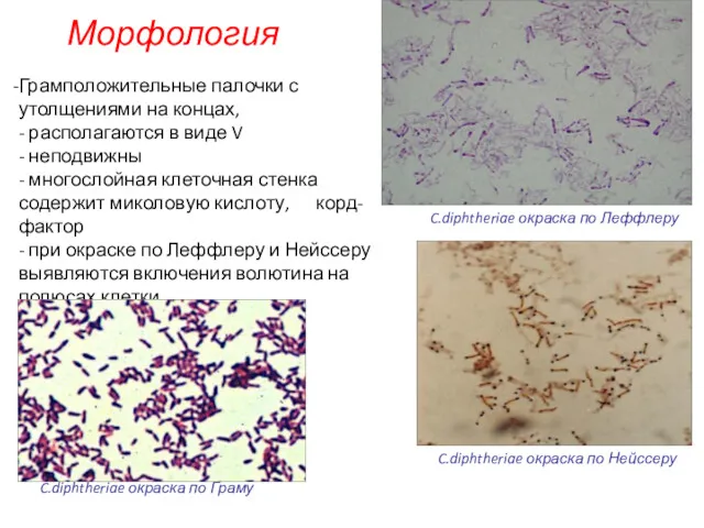 Морфология C.diphtheriae окраска по Леффлеру Грамположительные палочки с утолщениями на