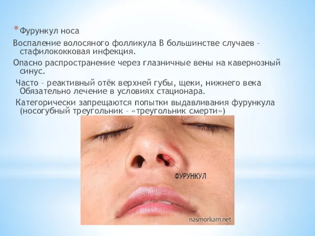 Фурункул носа Воспаление волосяного фолликула В большинстве случаев – стафилококковая инфекция. Опасно распространение