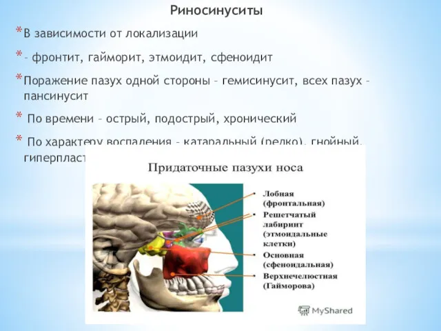 Риносинуситы В зависимости от локализации – фронтит, гайморит, этмоидит, сфеноидит