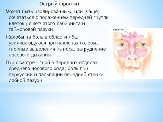 Острый фронтит Может быть изолированным, или (чаще) сочетаться с поражением