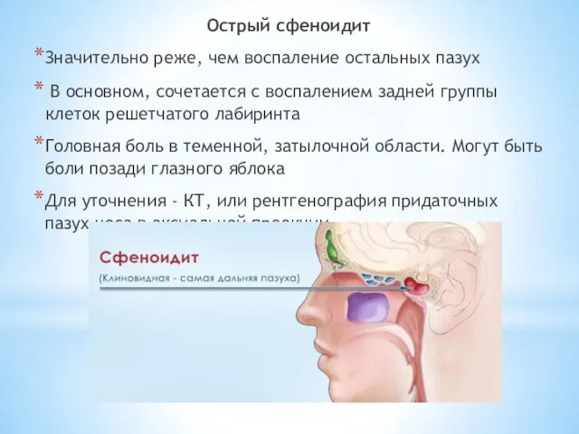 Острый сфеноидит Значительно реже, чем воспаление остальных пазух В основном, сочетается с воспалением