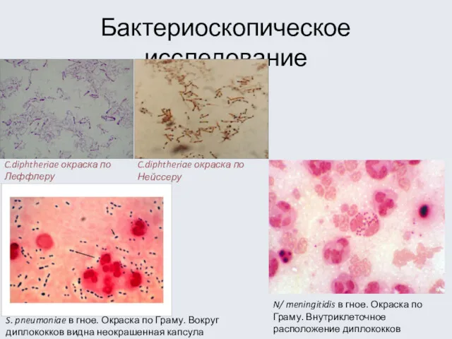 Бактериоскопическое исследование C.diphtheriae окраска по Леффлеру C.diphtheriae окраска по Нейссеру S. pneumoniae в