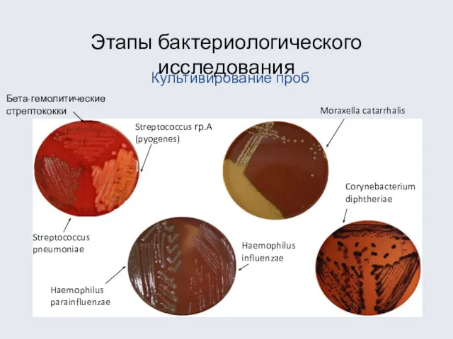 Этапы бактериологического исследования Культивирование проб Streptococcus pneumoniae Streptococcus гр.A (pyogenes) Бета-гемолитические стрептококки Haemophilus