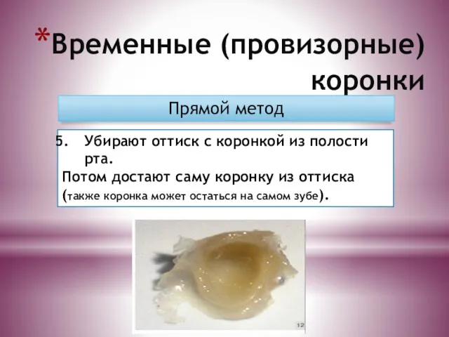 Временные (провизорные) коронки Прямой метод Убирают оттиск с коронкой из