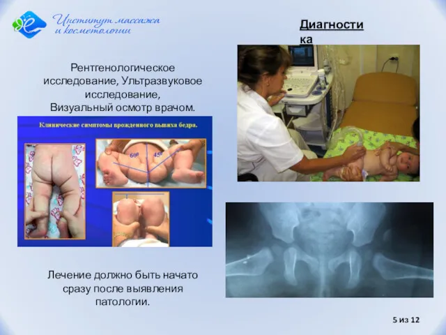 из 12 Рентгенологическое исследование, Ультразвуковое исследование, Визуальный осмотр врачом. Диагностика