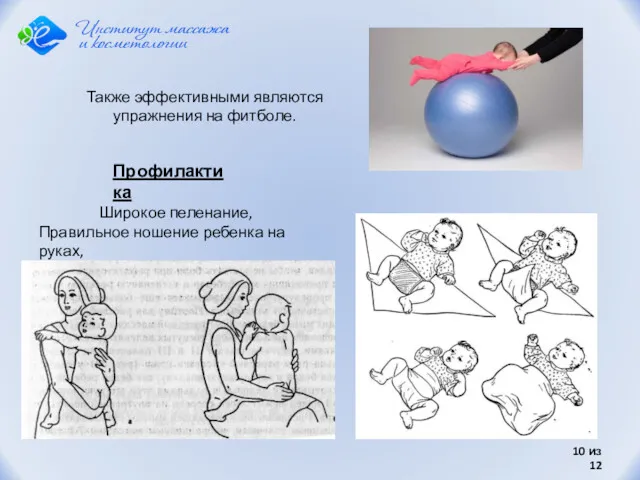 из 12 Широкое пеленание, Правильное ношение ребенка на руках, Профилактика Также эффективными являются упражнения на фитболе.