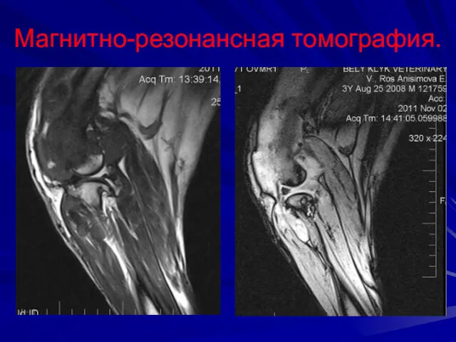 Магнитно-резонансная томография.