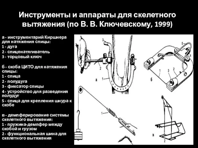 Инструменты и аппараты для скелетного вытяжения (по В. В. Ключевскому, 1999) а -