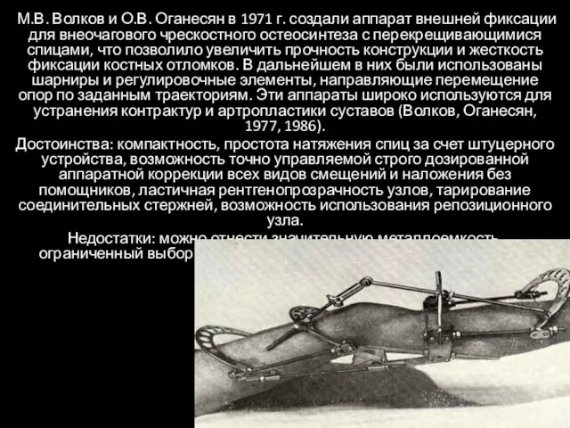 М.В. Волков и О.В. Оганесян в 1971 г. создали аппарат внешней фиксации для