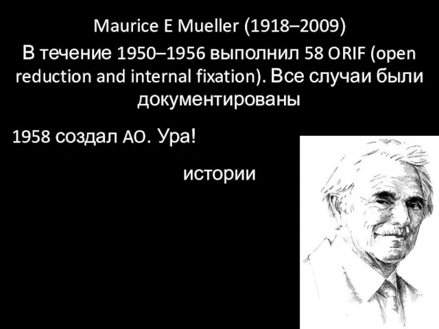 Maurice E Mueller (1918–2009) В течение 1950–1956 выполнил 58 ORIF (open reduction and