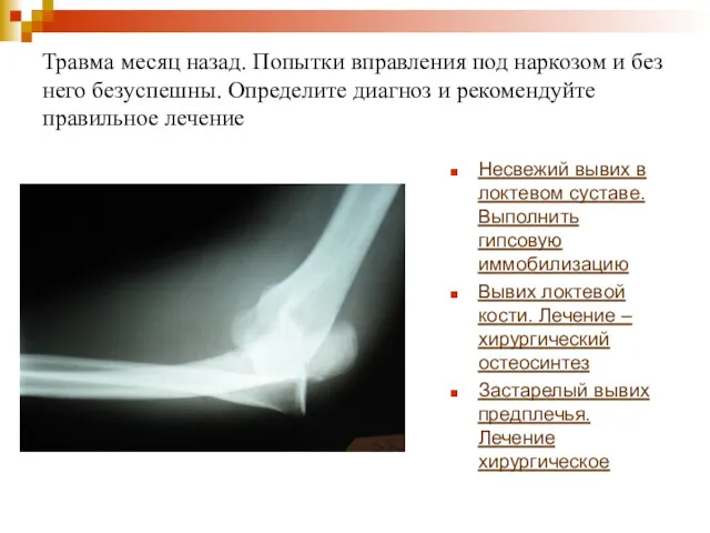 Травма месяц назад. Попытки вправления под наркозом и без него