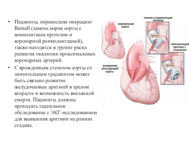 Пациенты, перенесшие операцию Bentall (замена корня аорты с композитным протезом