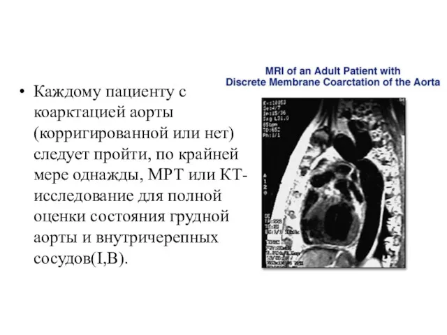 Каждому пациенту с коарктацией аорты (корригированной или нет) следует пройти,