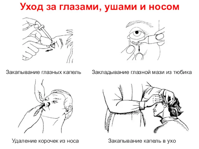 Уход за глазами, ушами и носом Закапывание глазных капель Закладывание