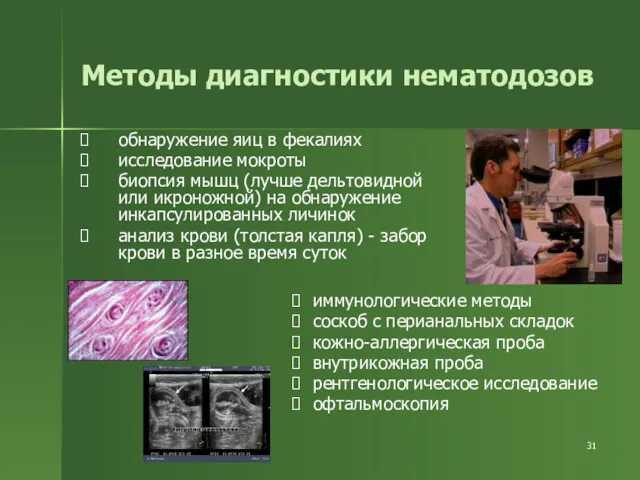 Методы диагностики нематодозов обнаружение яиц в фекалиях исследование мокроты биопсия