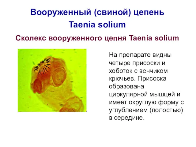 Вооруженный (свиной) цепень Taenia solium Сколекс вооруженного цепня Taenia solium