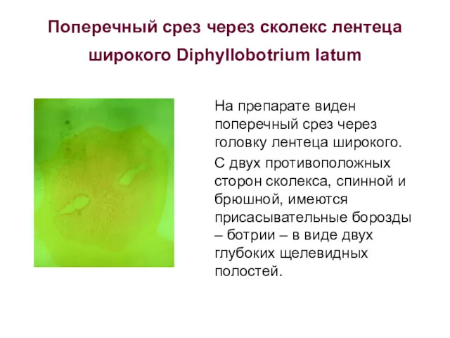 Поперечный срез через сколекс лентеца широкого Diphyllobotrium latum На препарате