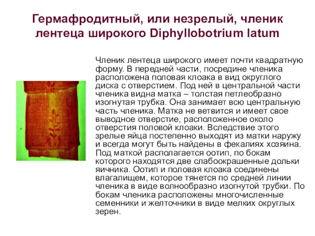 Гермафродитный, или незрелый, членик лентеца широкого Diphyllobotrium latum Членик лентеца