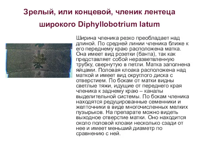 Зрелый, или концевой, членик лентеца широкого Diphyllobotrium latum Ширина членика