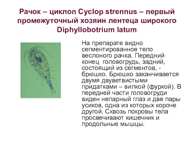 Рачок – циклоп Cyclop strennus – первый промежуточный хозяин лентеца