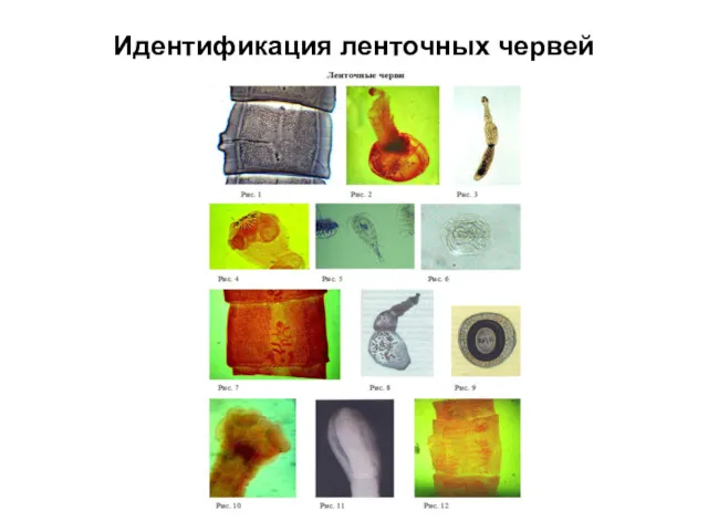 Идентификация ленточных червей