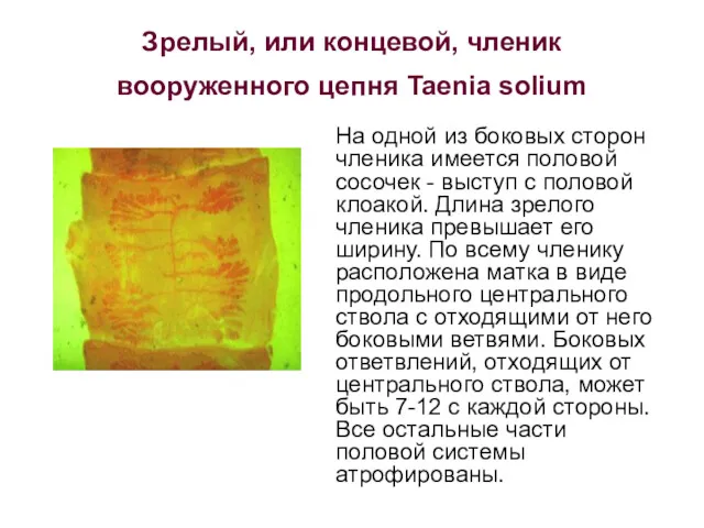 Зрелый, или концевой, членик вооруженного цепня Taenia solium На одной