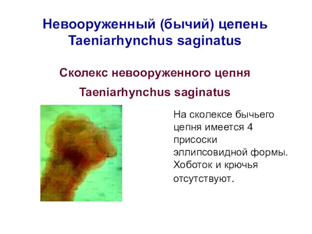 Невооруженный (бычий) цепень Taeniarhynchus saginatus Сколекс невооруженного цепня Taeniarhynchus saginatus